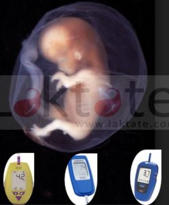 Comparing fetal scalp lactate and umbilical cord arterial blood gas values